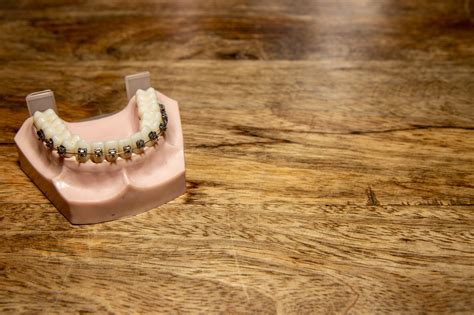 pinay flix1|The Truth Behind Crooked Bottom Teeth: Causes and .